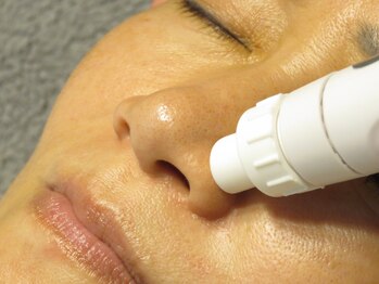 チェスタの写真/毛穴の黒ずみ、ポツポツ毛穴…放置していませんか?古い角質を取り除き、すっぴん美肌を叶えます!