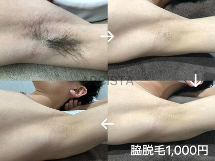 アルシスタ(ARCISTA)の写真