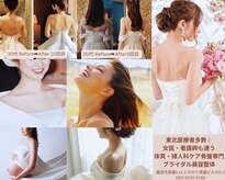 ビルーチェ(美LUCE)