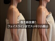 アロマ整体ドレナージュで美姿勢◇フェイスラインもスッキリ小顔