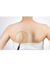 アロエ鍼灸整体院/肩甲骨はがし