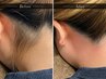 新規【見られる季節のうなじケア★】うなじダブル脱毛(Wax+光脱毛)