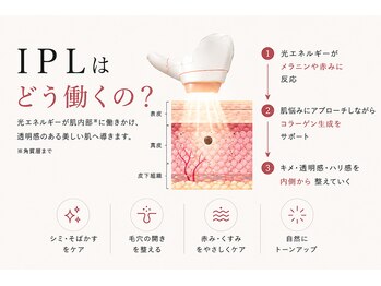 アフロディーテ(Aphrodite)/◆光フェイシャル◆