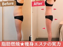 サロン ド ミュゲの雰囲気（実際の痩身エステの事例です♪痩せたい応援します♪）