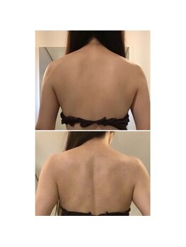 カリーナ(Carina)の写真/結婚式や前撮り・後撮りなど、大切な日に向けて理想の身体作りをサポート♪丁寧にカウンセリング致します☆