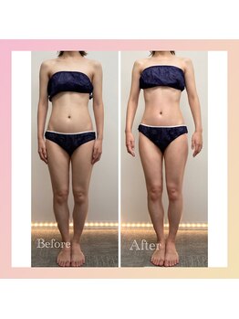 ナタリー(Natalie)/全身インディバ