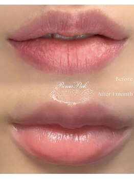 パシテア(Pasithea)/ローマピンク