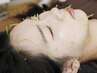 新規限定！美顔鍼　お顔のみ　40分