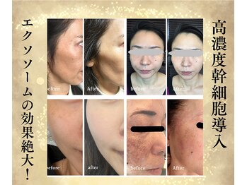 サンテボーテ(Sante Beaute)/50代オトナ女性の肌改善