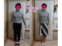 ミミスリム 赤羽(MimiSlim)/50歳主婦　3ヶ月で－15.1kg！