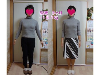 ミミスリム 赤羽(MimiSlim)/50歳主婦　3ヶ月で－15.1kg！