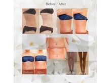 ルシェルシェ(RECHERCHER)の雰囲気（骨格から改善する強めなマッサージと痩身機器でサイズダウン！）