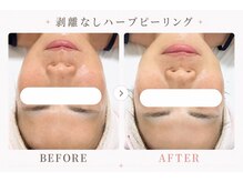 パールプラス 大垣店(Pearl plus)/じっくり肌育☆トーンアップ◎