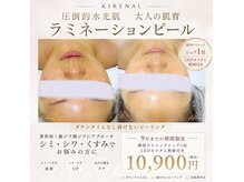 キレナル(KIRENAL)の雰囲気（ラミピール進化版☆韓国に行かなくても大阪で肌管理◎）
