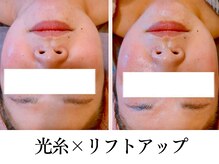 ボディメイキング キキ(Bodymaking KIKI)の雰囲気（毛穴ケア・リフトアップ・小顔・ヘッドスパなど豊富なメニュー）