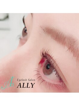 アリー(ALLY)/