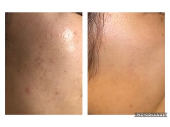 オアジスパ(Oasi Spa)/