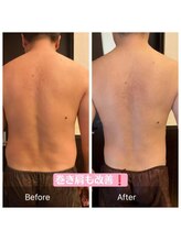 ウノジェンネ UNO DJENNE/背中に驚き!痩身リンパEMSキャビ