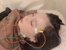 ユウビビューティサロン 東生駒(Yuubi Beauty Salon)の雰囲気（美容鍼ですっりき小顔、むくみ対策【剥離なしハーブピーリング】）