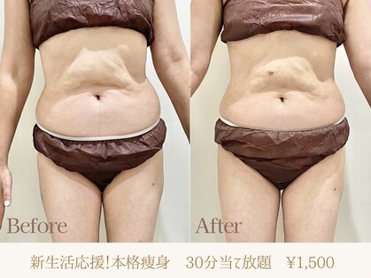 シェア(share)の写真