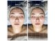 サロン ニコ(salon NICO)の写真