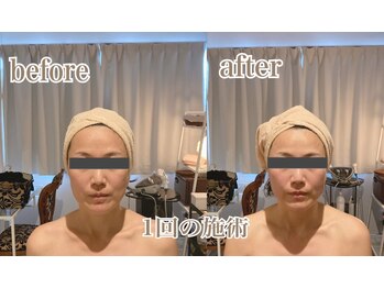 ラ フルール 折尾店/小顔矯正コルギ