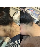 シャンティ(Shanti)/うなじ美人