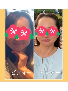 ルクシア(Luxia)/お顔バランス改善