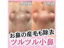 ホワイトワックス 名古屋金山店(WHITE WAX)の雰囲気（フェイシャル/エステ/脱毛/顔脱毛/フェイシャルワックス/）