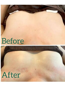 ホットナンバー(HOT number)/初回でバストUPも付いてます