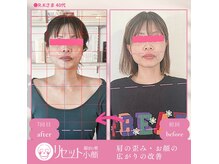 小顔アンド頭蓋骨調整専門 ゆるみ施術院