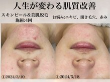 ヨク 梅田(YOKU)