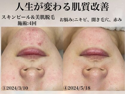 ヨク 梅田(YOKU)の写真