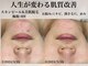 ヨク 梅田(YOKU)の写真