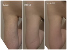 エルール トータルビューティ(Aileure total beauty)