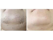 ミューシェリー(Mieux Cherie)/マスクが外せる幸せる