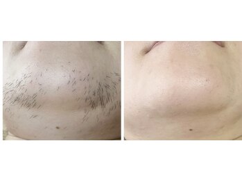 ミューシェリー(Mieux Cherie)/マスクが外せる幸せる