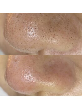 毛穴専科/毛穴洗浄+白玉ワックス メンズ◎