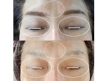 ベリッシモ(bellissimo)の雰囲気（しわ・くすみケアにはダーマエステがおすすめです。）