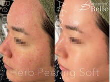 ベル 渋谷(belle)/ハーブピーリング｜店内内装