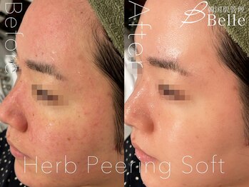 ベル 渋谷(belle)/ハーブピーリング|店内内装