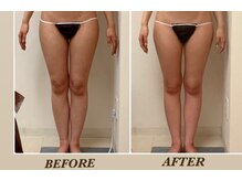 プリマ(Prima)/BEFORE&AFTER