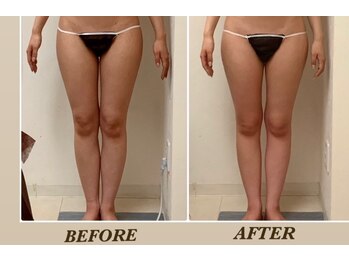 プリマ(Prima)/BEFORE&AFTER