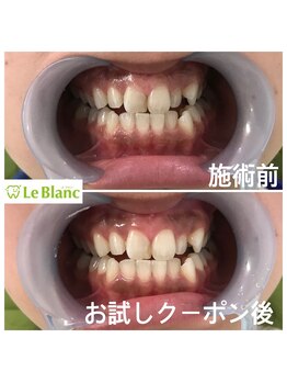 ルブラン 奈良店(Le Blanc)/フリーパススタート！！