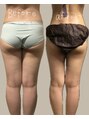 エン(enn.) 私自身もダイエット経験者。産後18kgのダイエットに成功。