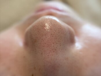 リセットプラス(Reset+)/