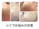 トータルエステ ユキ(YUKI)の写真