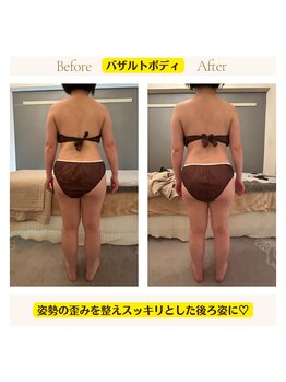 アイシー(I Sea)/バザルトボデ+ヘッド