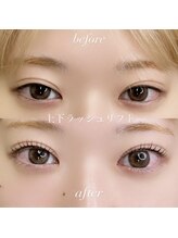 アイズ(i's)/〔上下ラッシュリフト〕