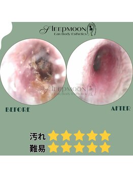 スリープムーン(Sleep MOON)/